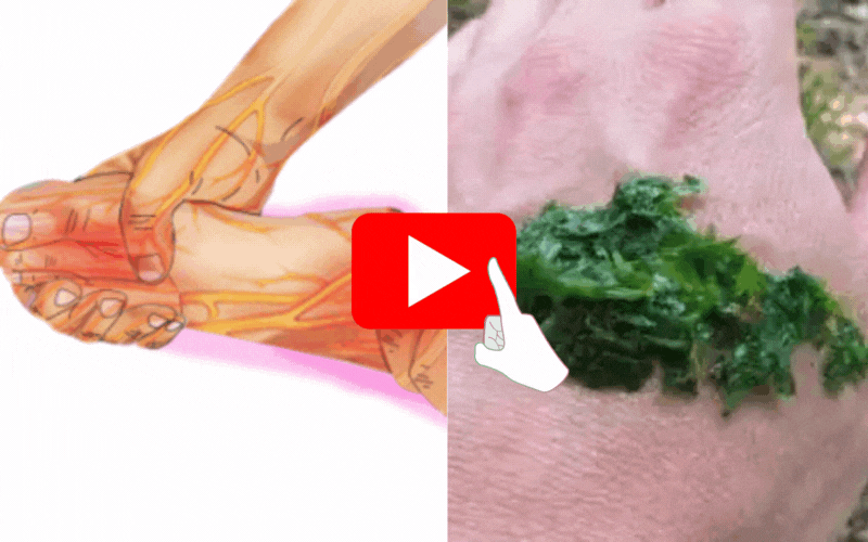 Watch the free video